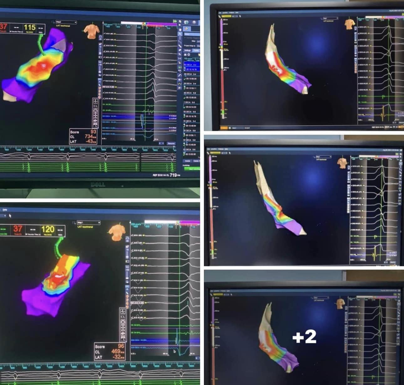 الضربة الساقطة