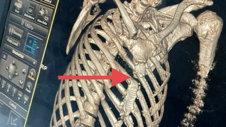 جانب من الجراحة