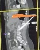 مستشفيات قصر العينى