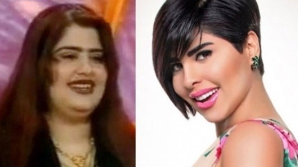 فنانات بعد التجميل