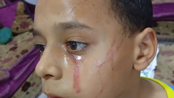 الطالب المعتدى عليه الطالب المعتدى عليه