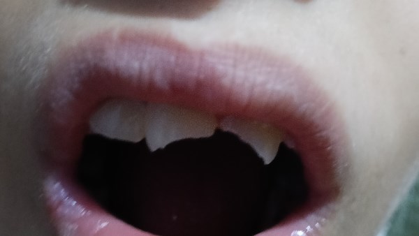 إصابات الطالب المعتدى عليه