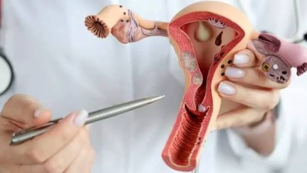 كيف ينزل تكيس المبايض مع الدورة؟