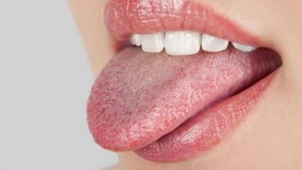 طرق طبيعية لعلاج فطريات الفم 