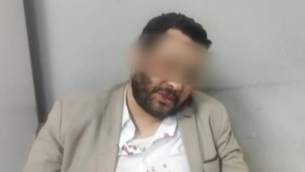 المحامي المعتدى عليه بسوهاج