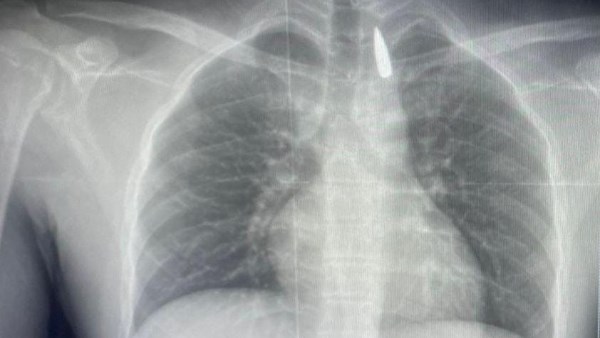 صورة من الاشعة