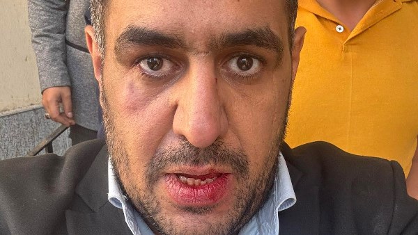 المرشح ضحية الاعتداء بالغربية 