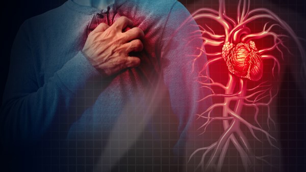 أعراض الذبحة الصدرية