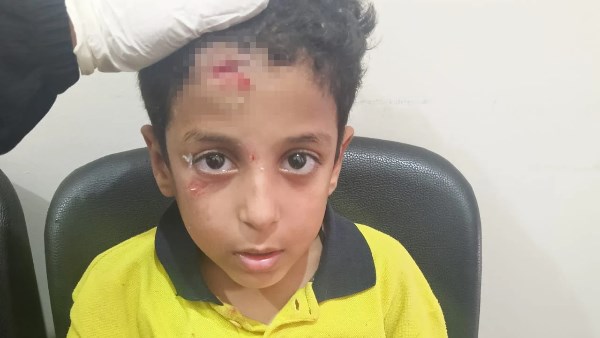 الطفل المصاب