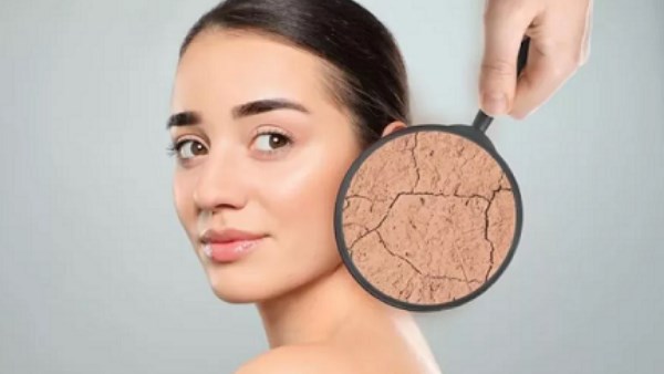 8 طرق طبيعية وآمنة للعناية بالبشرة الجافة| تعرفي عليها