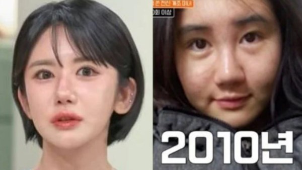 هوس عمليات التجميل.. امرأة كورية تجري 400 عملية تجميل خلال 15 عام هوس عمليات التجميل.. امرأة كورية تجري 400 عملية تجميل خلال 15 عام