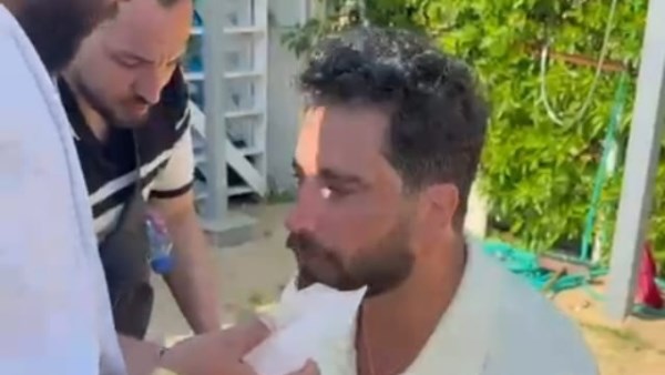 إصابة الفنان معتصم النهار خلال تصوير مشاهده بفيلم «نصيب» بالغردقة.. صور