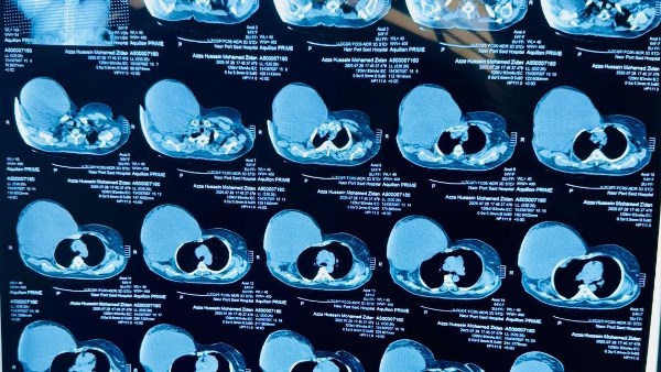 أشعة المريض 