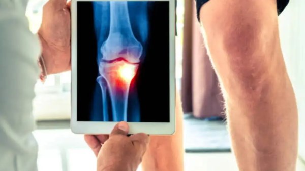 3 طرق بسيطة وطبيعية لتخفيف آلام الركبة والتهاب المفاصل.. فما هما؟ 3 طرق بسيطة وطبيعية لتخفيف آلام الركبة والتهاب المفاصل.. فما هما؟