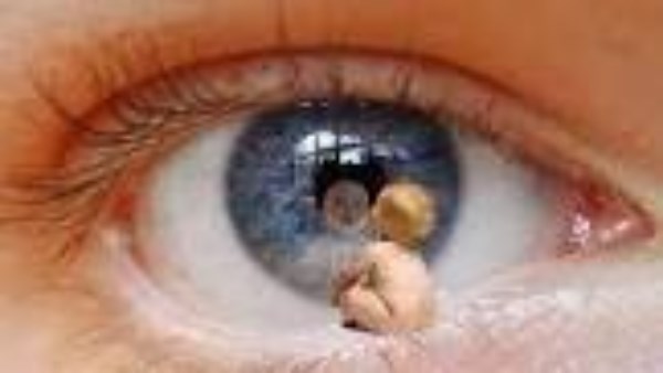 ابني مصاب بالعين والحسد