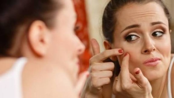 أسباب ظهور حب الشباب بعد سن الثلاثين