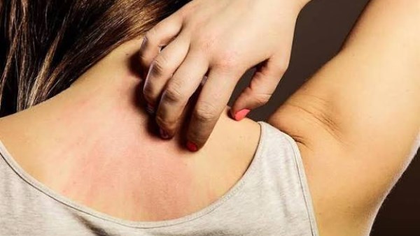 أسباب الحكة الجلدية