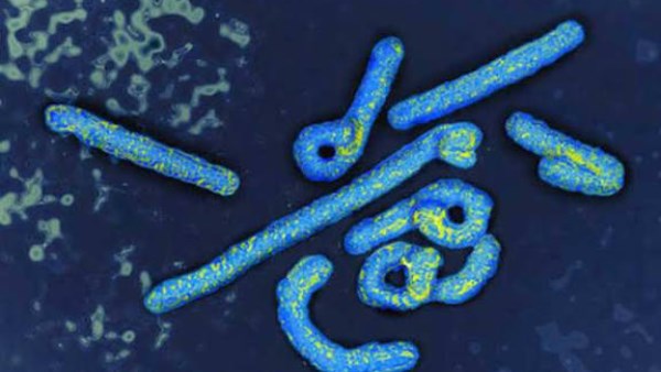 فيروس ماربورج 