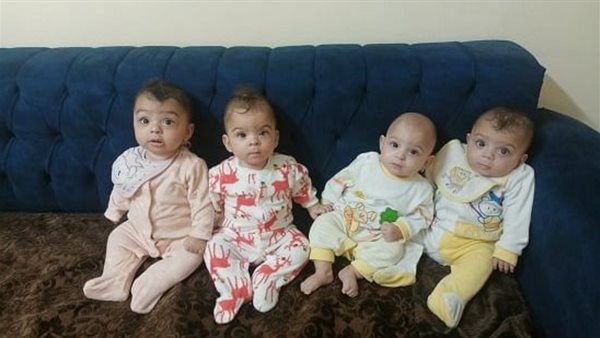 حالة  الأربعة توائم