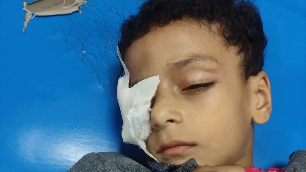 الطفل المصاب