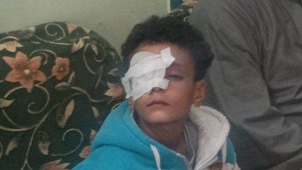 الطفل المصاب