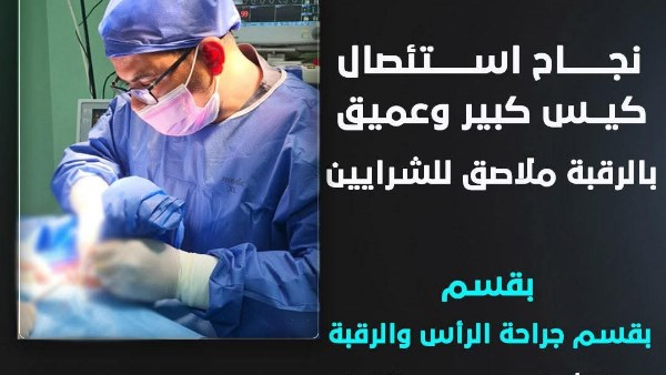 استئصال كيس ضخم ملاصق لشرايين الرقبة في عملية معقدة تنجح داخل مستشفى حورس التخصصي بالأقصر