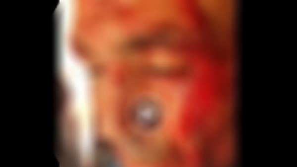 المجنى عليه