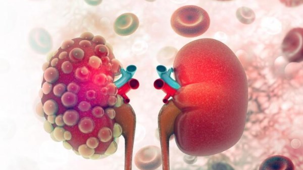 اعراض مرض الكلى