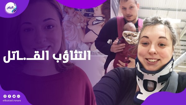 امرأة كادت تفقد حياتها بسبب "تثاؤب"