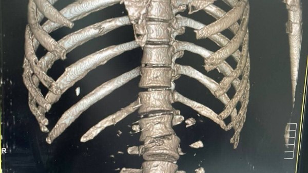 صورة موضوعية