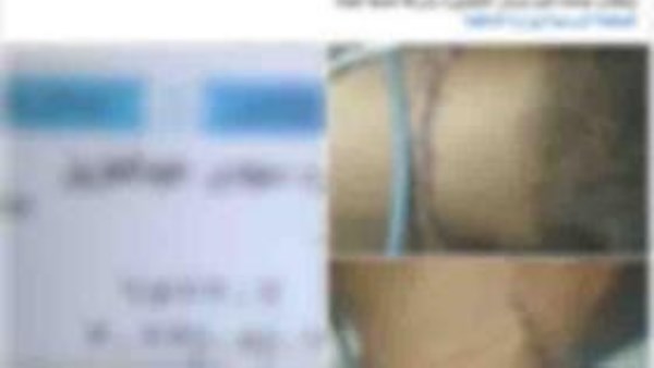 بسبب خلافات الجيرة.. شقيقان يعتديان على بعضهما بالأسلحة البيضاء بالدقهلية