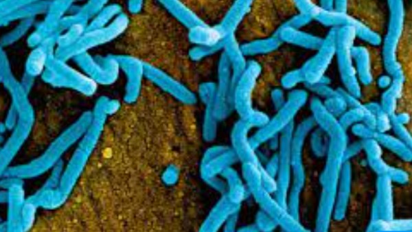 فيروس ماربورج