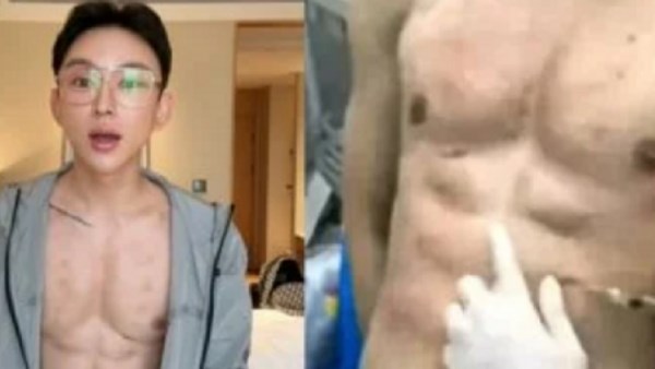 عضلات بطن اصطناعية.. هوس المظهر الخارجي تدفع الشباب إلى ما لا يصدقه العقل| إيه الحكاية؟