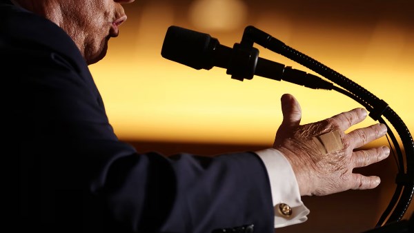 سبب وضع ترامب ضمادة على يده