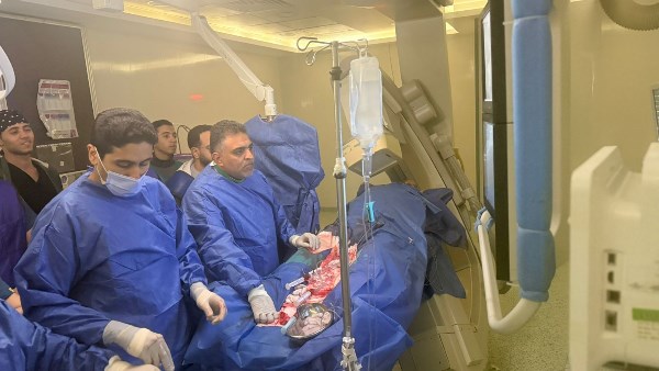 التحضير للعلميات 