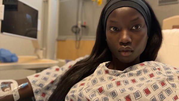 )من عروض الأزياء إلى غرفة العمليات..أنوك ياي تكشف عن مرضها وتخضع لجراحة دقيقة 