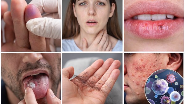 علامة واحدة في جسدك قد تكشف نقص فيتامين خطير لا يجب تجاهله 