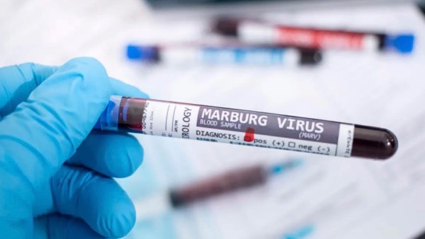 الوقاية من فيروس ماربورج