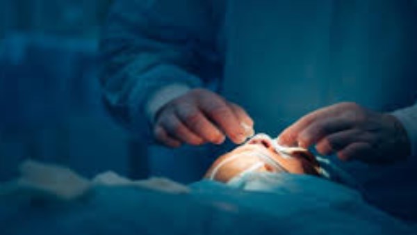 حكم إجراء عملية تجميل لفتاة تعاني من تشوه