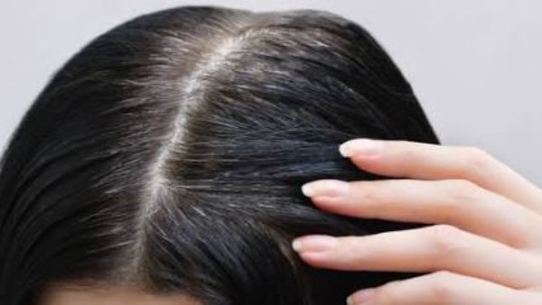 أسباب ظهور الشيب المبكر