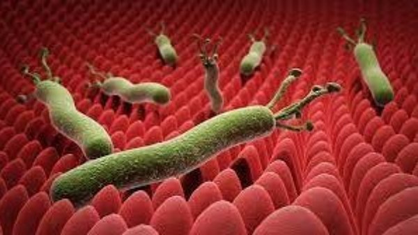 جرثومة المعدة