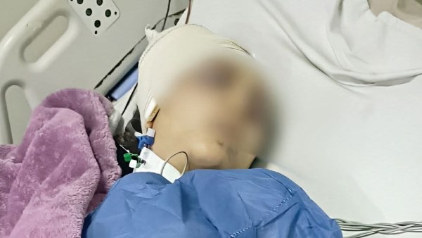 الفتاة المصابة