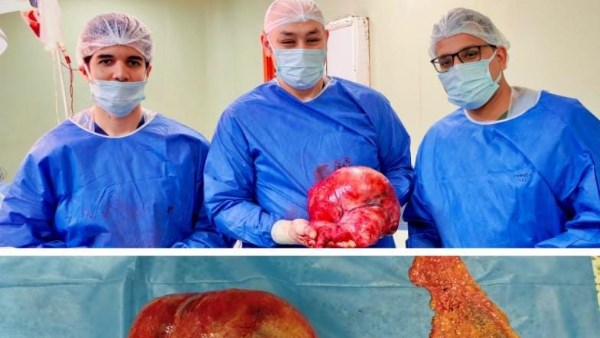 محافظ بني سويف يُشيد بأعضاء طاقم طبي بعد نجاحه في إجراء جراحة دقيقة لاستئصال ورم سرطاني ضخم لسيدة مسنّة