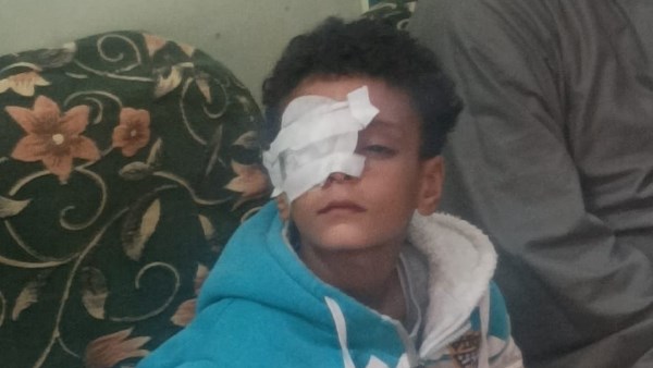 الطفل المصاب