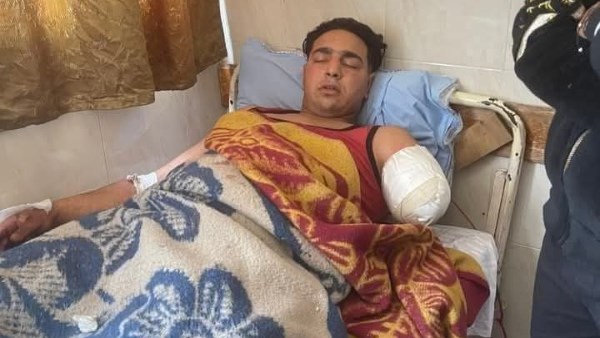 عامل السيرك المصاب بطنطا 