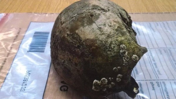 جمجمه بشرية 