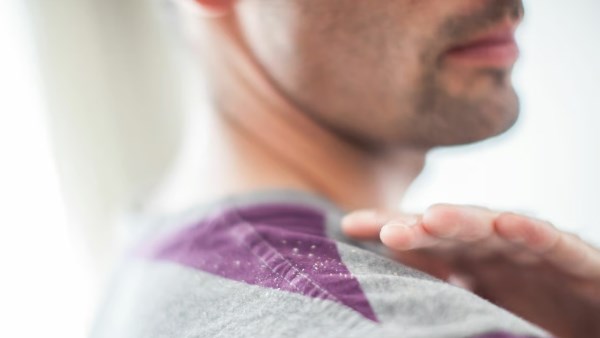 فطريات فروة الرأس الأسباب والأعراض وطرق العلاج الفعالة