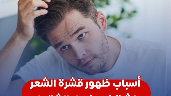 ظهور قشرة الشعر 