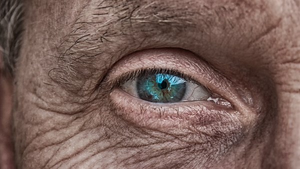 علاج حساسية العين بالاعشاب