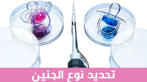 حكم تحديد نوع الجنين خلال عملية حقن مجهرى